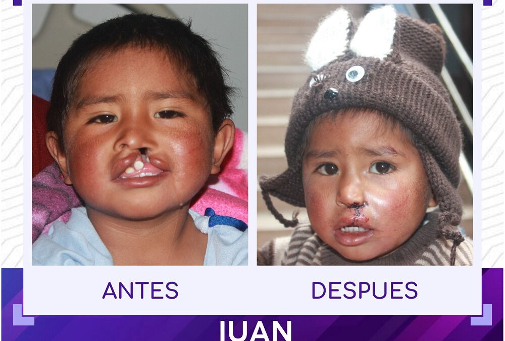 Coya, Peru – November 2021