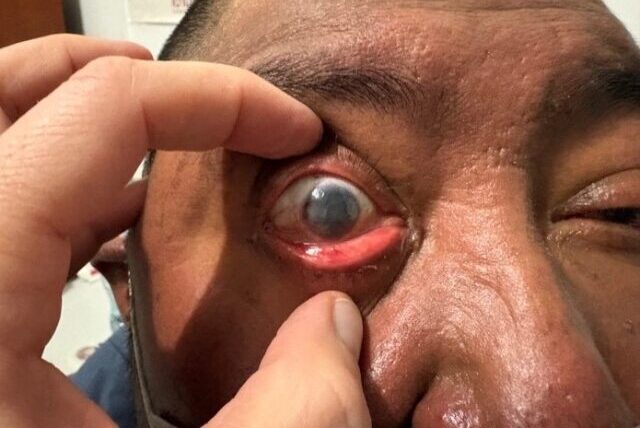 Coya, Peru – August 2025